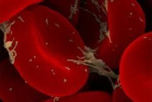 چطور بفهمیم چربی خون‌‌ داریم؟