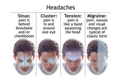 انواع سردرد, دلایل و درمان بعضی از سردرد ها