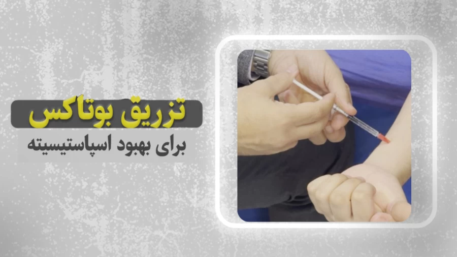  رفع مشکل اسپاسیتیسی دست در بیماران سکته مغزی